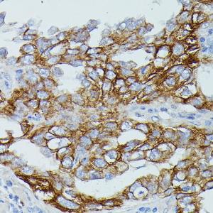 Anti-CD64 Rabbit Polyclonal Antibody