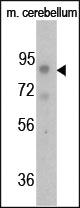 Anti-FGFR Rabbit Polyclonal Antibody