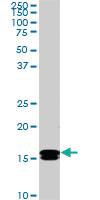 Anti-NME2 Mouse Monoclonal Antibody [clone: 1A9]