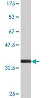 Anti-S100 A11 Mouse Monoclonal Antibody [clone: 1B12]