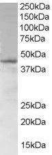 Anti-SAMSN1 antibody