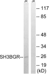 Western blot analysis of lysates from Jurkat cells using Anti-SH3BGR Antibody. The right hand lane represents a negative control, where the antibody is blocked by the immunising peptide