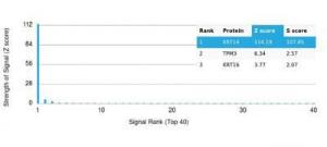 Analysis of protein array containing more than 19,000 full-length human proteins using Anti-Cytokeratin 14 Antibody [KRT14/4125] Z-Score and S- Score