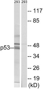 Western blot analysis of lysates from 293 cells using Anti-p53 Antibody. The right hand lane represents a negative control, where the antibody is blocked by the immunising peptide