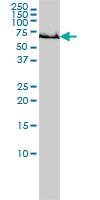 Anti-GCLC Mouse Monoclonal Antibody [clone: 3H1]