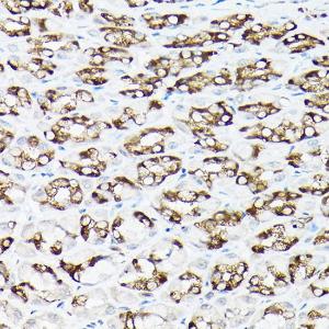 Antibody anti-SLC8A1 100 µl