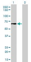 Anti-GCLC Mouse Monoclonal Antibody [clone: 3H1]