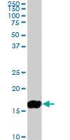 Anti-NME2 Mouse Monoclonal Antibody [clone: 1A9]