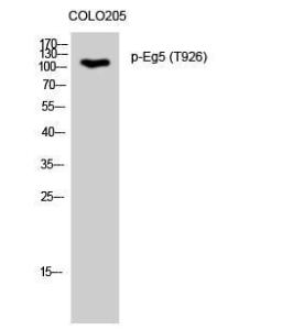 Western blot analysis of COLO205 cells using Anti-KIF11 (phospho Thr926) Antibody