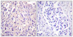 Anti-UBE1L antibody