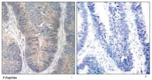 Anti-EIF2AK2 Rabbit Polyclonal Antibody