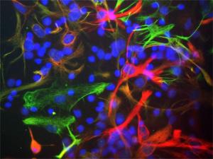 Mixed cultures of neonatal rat neurons and glia stained with Anti-Nestin Antibody (red), Anti-Vimentin Antibody (A85421/green) and DNA (DAPI stain/blue)