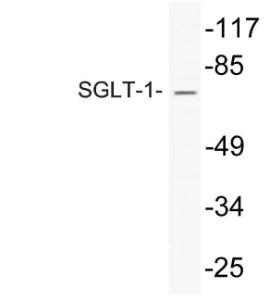 Western blot analysis of lysate from HepG2 cells using Anti-SGLT-1 Antibody