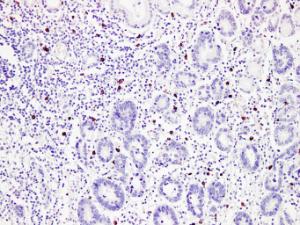 Immunohistochemical analysis of paraffin-embedded human Stomach using Anti-Mast Cell Tryptase Antibody