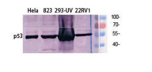 Western blot analysis of various cells using Anti-p53 Antibody