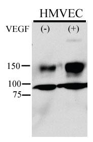 Anti-KDR Rabbit Polyclonal Antibody