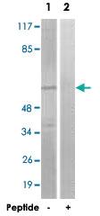 Anti-GRK1 Rabbit Polyclonal Antibody