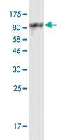 Anti-CDH11 Mouse Monoclonal Antibody [clone: 3C20]