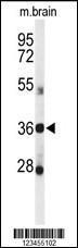 Anti-DDO Rabbit Polyclonal Antibody (AP (Alkaline Phosphatase))