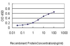 Anti-GCLC Mouse Monoclonal Antibody [clone: 3H1]