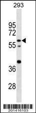 Anti-CNOT4 Mouse Monoclonal Antibody (HRP (Horseradish Peroxidase)) [clone: 343CT14.6.5]