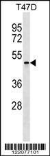 Anti-APOBEC4 Rabbit Polyclonal Antibody (AP (Alkaline Phosphatase))