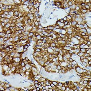 Anti-CD64 Rabbit Polyclonal Antibody