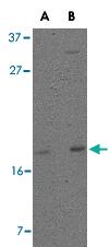 Anti-DPPA3 Rabbit Polyclonal Antibody