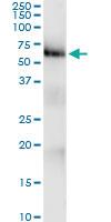 Anti-KIAA0226L Polyclonal Antibody Pair