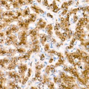 Immunohistochemistry analysis of paraffin-embedded human liver (primary antibody is acox1) using Goat Anti-Mouse IgG1 Antibody (HRP) (A93381) at a dilution of 1:1,000 (40X lens). Perform high pressure antigen retrieval with 10 mM citrate buffer pH 6.0 before commencing with IHC staining protocol