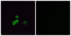 Antibody anti-OR5U1 100 µg