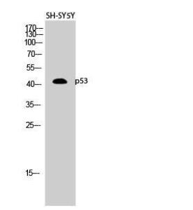 Western blot analysis of SH SY5Y cells using Anti-p53 Antibody