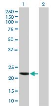 Anti-CCDC115 Mouse Polyclonal Antibody