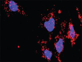 Anti-BIRC3 + NFKB1 Antibody Pair