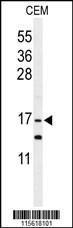 Anti-GMFG Rabbit Polyclonal Antibody