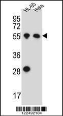 Anti-HAS2 Rabbit Polyclonal Antibody (AP (Alkaline Phosphatase))