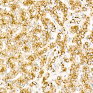 Immunohistochemistry analysis of paraffin-embedded human liver (the primary antibody is acox1, and the control secondary antibody is stained) using Goat Anti-Mouse IgG1 Antibody (HRP) (A93381) at a dilution of 1:1,000 (40X lens)