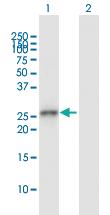 Anti-GCLM Rabbit Polyclonal Antibody