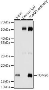 Immunoprecipitation analysis of 200 µg extracts of HeLa cells using 3 µg of Anti-TOMM20 Antibody [ARC5002-01] (A309191) This Western blot was performed on the immunoprecipitate using Anti-TOMM20 Antibody [ARC5002-01] (A309191) at a dilution of 1:1000