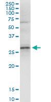 Anti-GCLM Rabbit Polyclonal Antibody