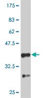 Anti-PTEN Mouse Monoclonal Antibody [clone: 3E7]