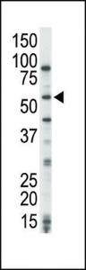 Anti-CROT Rabbit Polyclonal Antibody (HRP (Horseradish Peroxidase))