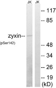 Western blot analysis of lysates from Jurkat cells treated with paclitaxel 1 µM 24 h using Anti-Zyxin (phospho Ser142) Antibody. The right hand lane represents a negative control, where the Antibody is blocked by the immunising peptide