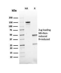 Anti-ACTH Mouse Recombinant Antibody [clone: rCLIP/1407]