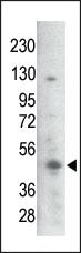 Anti-GSK3B Rabbit Polyclonal Antibody