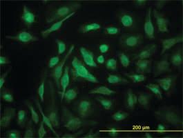 Anti-NME2 Mouse Monoclonal Antibody [clone: 1A9]