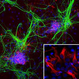 Immunofluorescent analysis of cortical neuron-glial cell culture from E20 rat stained