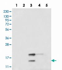 Anti-RBM48 Rabbit Polyclonal Antibody