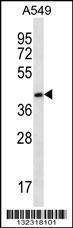 Anti-FBLIM1 Rabbit Polyclonal Antibody (AP (Alkaline Phosphatase))