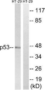 Western blot analysis of lysates from HT-29 cells, treated with calyculin A 50ng/ml 30' using Anti-p53 Antibody. The right hand lane represents a negative control, where the antibody is blocked by the immunising peptide